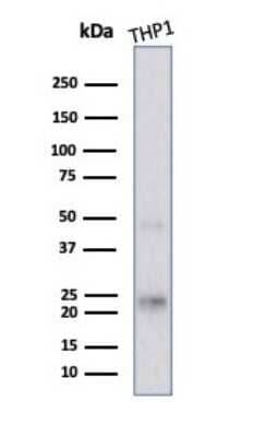 Western Blot: LMO2 Antibody (rLMO2/1971) - Azide and BSA Free [NBP3-08285] - Western blot analysis of THP1 cell lysate using LMO2 antibody (rLMO2/1971).