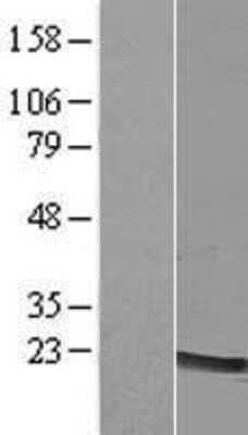 Western Blot: LMO2 Overexpression Lysate (Adult Normal) [NBP2-07732] Left-Empty vector transfected control cell lysate (HEK293 cell lysate); Right -Over-expression Lysate for LMO2.