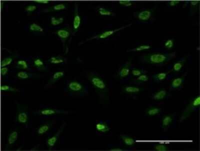 Immunocytochemistry/Immunofluorescence: LMO4 Antibody (2B6) [H00008543-M02] - Analysis of monoclonal antibody to LMO4 on HeLa cell . Antibody concentration 10 ug/ml.