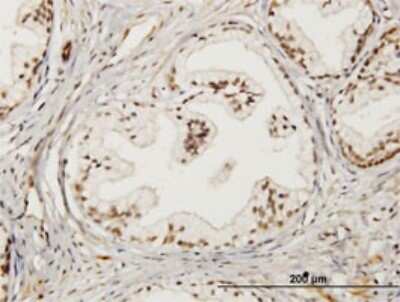 Immunohistochemistry-Paraffin: LMO4 Antibody (2B6) [H00008543-M02] - Analysis of monoclonal antibody to LMO4 on formalin-fixed paraffin-embedded human prostate. Antibody concentration 3 ug/ml.