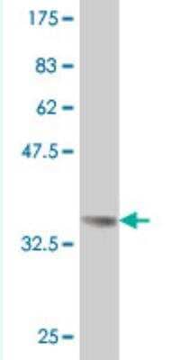 Western Blot: LMO4 Antibody (3B4) [H00008543-M04] - Detection against Immunogen (37.99 KDa) .