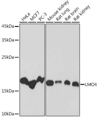 Western Blot: LMO4 Antibody (5C0I1) [NBP3-16630] - Western blot analysis of extracts of various cell lines, using LMO4 Rabbit mAb (NBP3-16630) at 1:1000 dilution. Secondary antibody: HRP Goat Anti-Rabbit IgG (H+L) at 1:10000 dilution. Lysates/proteins: 25ug per lane. Blocking buffer: 3% nonfat dry milk in TBST. Detection: ECL Basic Kit. Exposure time: 180s.