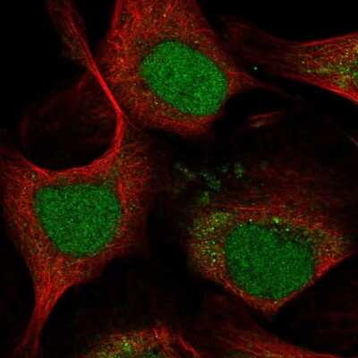 Immunocytochemistry/Immunofluorescence: LMO4 Antibody [NBP2-58657] - Staining of human cell line U-2 OS shows localization to nucleus & cytosol.