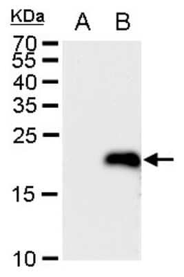 Western Blot: LMO4 Antibody [NBP2-43538] - Analysis of A. 30 ug 293T whole cell extract B. 30 ug whole cell extract of human LMO4-transfected 293T cells 12 % SDS-PAGE LMO4 antibody dilution: 1:5000.