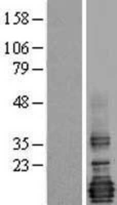 Western Blot: LMO4 Overexpression Lysate (Adult Normal) [NBL1-12568] Left-Empty vector transfected control cell lysate (HEK293 cell lysate); Right -Over-expression Lysate for LMO4.