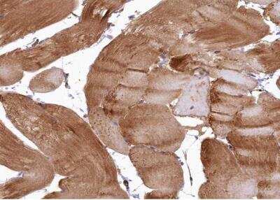 Immunohistochemistry-Paraffin LMOD3 Antibody