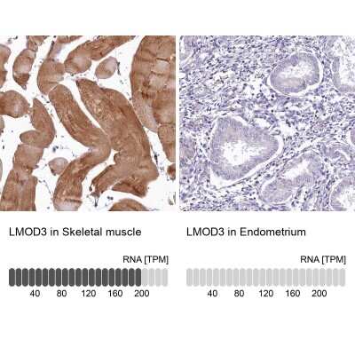 Immunohistochemistry-Paraffin LMOD3 Antibody