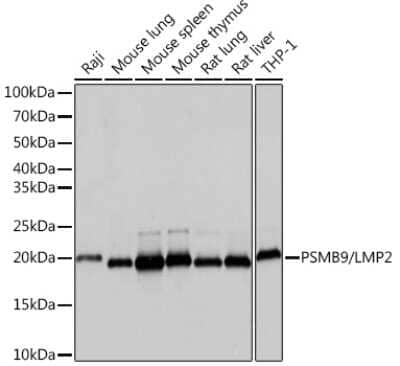 Western Blot: LMP2/PSMB9 Antibody (7Q2G4) [NBP3-16823] - Western blot analysis of extracts of various cell lines, using LMP2/PSMB9 Rabbit mAb (NBP3-16823) at 1:1000 dilution. Secondary antibody: HRP Goat Anti-Rabbit IgG (H+L) at 1:10000 dilution. Lysates/proteins: 25ug per lane. Blocking buffer: 3% nonfat dry milk in TBST. Detection: ECL Basic Kit. Exposure time: 1s.