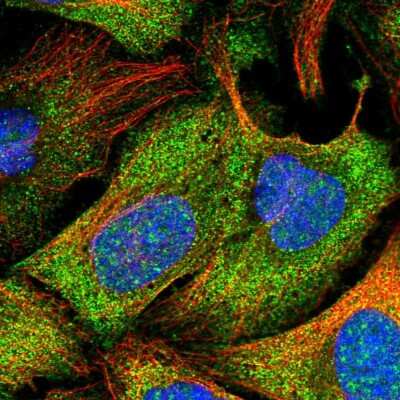 Immunocytochemistry/Immunofluorescence: LMP2/PSMB9 Antibody [NBP2-55229] - Staining of human cell line U-2 OS shows localization to cytosol.