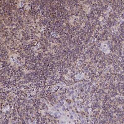 Immunohistochemistry: LMP2/PSMB9 Antibody [NBP2-33681] - Staining of human tonsil shows weak nuclear positivity in germinal center cells.