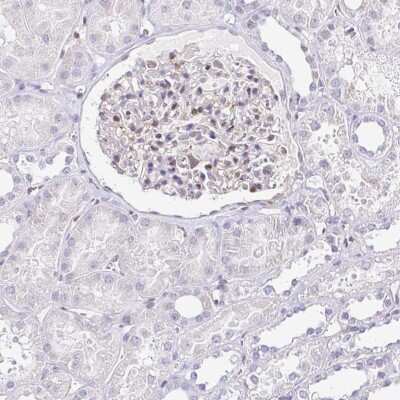 Immunohistochemistry-Paraffin: LMP2/PSMB9 Antibody [NBP2-33681] - Staining of human kidney shows low expression as expected.