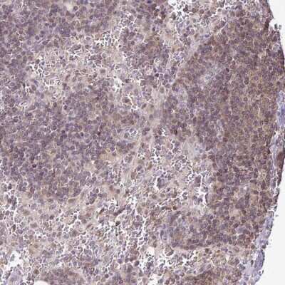 Immunohistochemistry-Paraffin: LMP2/PSMB9 Antibody [NBP2-33681] - Staining of human lymph node shows high expression.