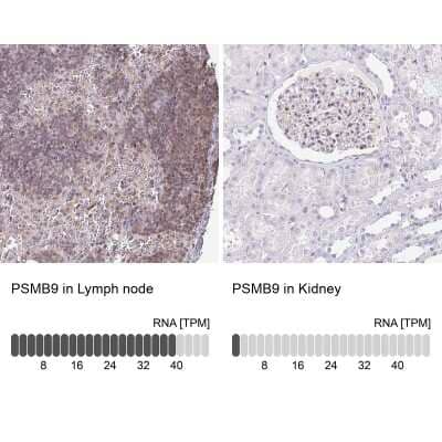 <b>Orthogonal Strategies Validation. </b>Immunohistochemistry-Paraffin: LMP2/PSMB9 Antibody [NBP2-33681] - Staining in human lymph node and kidney tissues using anti-PSMB9 antibody. Corresponding PSMB9 RNA-seq data are presented for the same tissues.