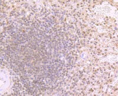 Immunohistochemistry-Paraffin: LMP2/PSMB9 Antibody (JB35-07) [NBP2-75553] - Analysis of paraffin-embedded human spleen tissue using anti-Proteasome 20S LMP2 antibody. Counter stained with hematoxylin.