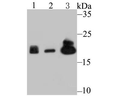 Western Blot: LMP2/PSMB9 Antibody (JB35-07) [NBP2-75553] - Analysis of Proteasome 20S LMP2 on different lysates using anti-Proteasome 20S LMP2 antibody at 1/500 dilution.Positive control:Lane 1: Mouse spleen tissue       Lane 2: U937     Lane 2: Mouse colon tissue