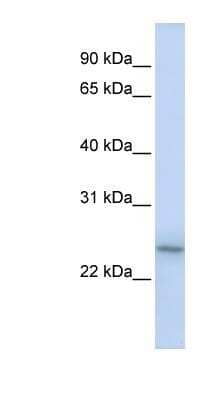 Western Blot: LMP2/PSMB9 Antibody [NBP1-58331] - Titration: 0.2-1 ug/ml, Positive Control: Jurkat cell lysate.