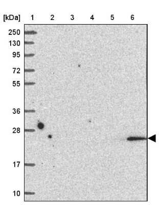 Western Blot LMP2/PSMB9 Antibody