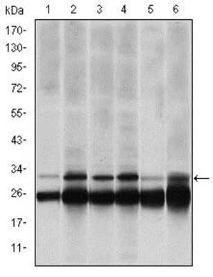 Western Blot: LMP7/PSMB8 Antibody (1A5) [NBP2-37570] - Western blot analysis using PSMB8 mouse mAb against Hela (1), MCF-7 (2), A431 (3), RAJI (4), MOTL4 (5) and PC-12 (6) cell lysate.