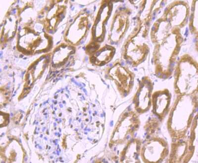 Immunohistochemistry-Paraffin: LMP7/PSMB8 Antibody (JB54-32) [NBP2-75554] - Analysis of paraffin-embedded human kidney tissue using anti-Proteasome 20S LMP7 antibody. Counter stained with hematoxylin.