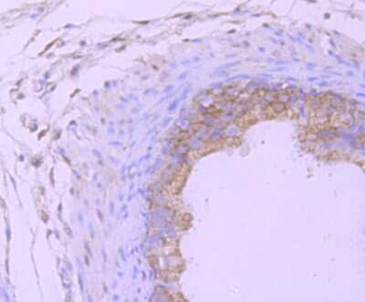 Immunohistochemistry-Paraffin: LMP7/PSMB8 Antibody (JB54-32) [NBP2-75554] - Analysis of paraffin-embedded rat epididymis tissue using anti-Proteasome 20S LMP7 antibody. Counter stained with hematoxylin.