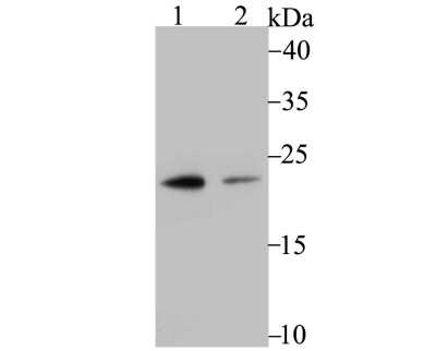Western Blot: LMP7/PSMB8 Antibody (JB54-32) [NBP2-75554] - Analysis of Proteasome 20S LMP7 on U937 (1) and A431 (2) cell lysate using anti-Proteasome 20S LMP7 antibody at 1/500 dilution.
