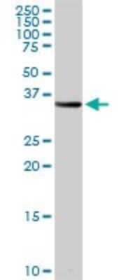 Western Blot: LMP7/PSMB8 Antibody [H00005696-D01P] - Analysis of PSMB8 expression in human kidney.