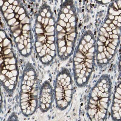 Immunohistochemistry-Paraffin: LMTK2 Antibody [NBP1-89320] - Staining of human colon shows cytoplasmic positivity in glandular cells.
