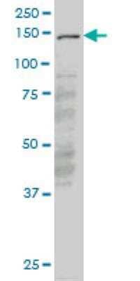 Western Blot: LMTK3 Antibody (6C5) [H00114783-M03] - LMTK3 monoclonal antibody (M03), clone 6C5 Western Blot analysis of LMTK3 expression in PC-12 ( Cat # L012V1 ).