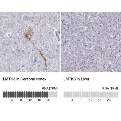 <b>Orthogonal Strategies Validation. </b>Immunohistochemistry-Paraffin: LMTK3 Antibody [NBP2-62711] - Analysis in human cerebral cortex and liver tissues using Anti-LMTK3 antibody. Corresponding LMTK3 RNA-seq data are presented for the same tissues.