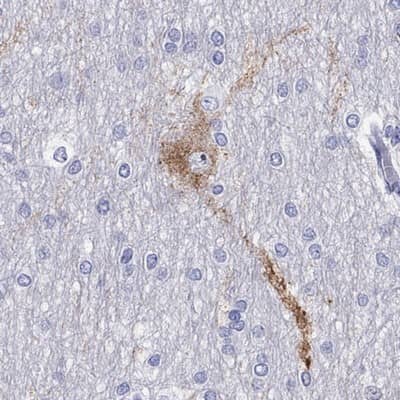 Immunohistochemistry-Paraffin: LMTK3 Antibody [NBP2-62711] - Staining of human cerebral cortex shows high expression.