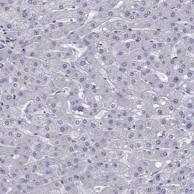 Immunohistochemistry-Paraffin: LMTK3 Antibody [NBP2-62711] - Staining of human liver shows low expression as expected.
