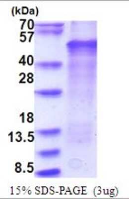 SDS-Page: LMX1b Recombinant Protein [NBP2-51742] - 15% SDS Page (3 ug)