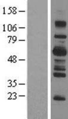 Western Blot: LNK Overexpression Lysate (Adult Normal) [NBL1-15917] Left-Empty vector transfected control cell lysate (HEK293 cell lysate); Right -Over-expression Lysate for LNK.
