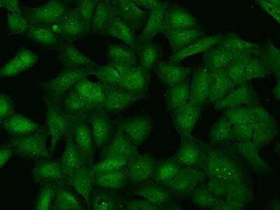 Immunocytochemistry/Immunofluorescence: LNK/SH2B3 Antibody [NBP3-06063] - Immunofluorescence staining of LNK/SH2B3 in U2OS cells. Cells were fixed with 4% PFA, permeabilzed with 0.1% Triton X-100 in PBS,blocked with 10% serum, and incubated with rabbit anti-Human SH2B3 polyclonal antibody (dilution ratio 1:200) at  4 degrees celsius overnight. Then cells were stained with the Alexa Fluor (TM) 488-conjugated Goat Anti-rabbit IgG secondary antibody (green). Positive staining was localized to Nucleus and Cytoplasm.