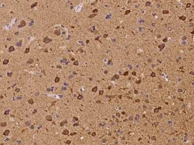 Immunohistochemistry: LNK/SH2B3 Antibody [NBP3-06063] - Immunochemical staining of human LNK/SH2B3 in human brain with rabbit polyclonal antibody at 1:300 dilution, formalin-fixed paraffin embedded sections.