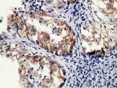Immunohistochemistry: LNK/SH2B3 Antibody (OTI2D8) - Azide and BSA Free [NBP2-72514] - Staining of paraffin-embedded Human pancreas tissue using anti-LNK mouse monoclonal antibody.