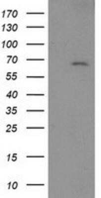 Western Blot: LNK/SH2B3 Antibody (OTI2D8) - Azide and BSA Free [NBP2-72514] - HEK293T cells were transfected with the pCMV6-ENTRY control (Left lane) or pCMV6-ENTRY LNK (Right lane) cDNA for 48 hrs and lysed. Equivalent amounts of cell lysates (5 ug per lane) were separated by SDS-PAGE and immunoblotted with anti-LNK.