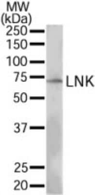 Western Blot: LNK/SH2B3 Antibody [NB100-2295] - NB100-2295 (0.3 ug/ml) staining of MOLT4 lysate (35 ug protein in RIPA buffer). Primary incubation was 1 hour. Detected by chemiluminescence.