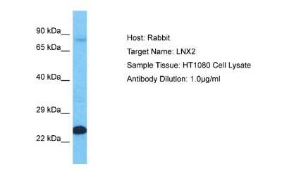 Western Blot: LNX2 Antibody [NBP2-87734] - Host: Rabbit. Target Name: LNX2. Sample Type: HT1080 Whole Cell lysates. Antibody Dilution: 1.0ug/ml