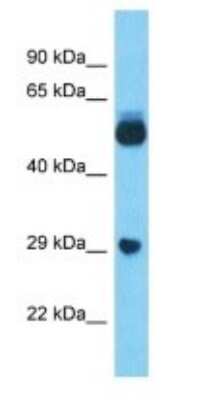 Western Blot: LOC100132249 Antibody [NBP3-09293] - Western blot analysis of LOC100132249 in Lung Tumor lysates. Antibody dilution at 1.0ug/ml