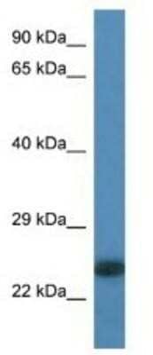 Western Blot: LOC100359980 Antibody [NBP1-74247] - Rat Liver Lysate 1ug/ml  Gel Concentration 12%