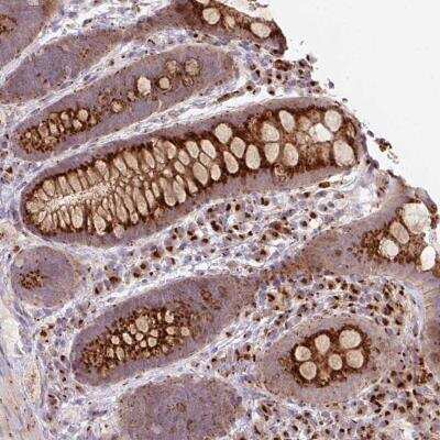 Immunohistochemistry-Paraffin: LOC100506127 Antibody [NBP2-47394] - Staining of human rectum shows strong granular cytoplasmic positivity in glandular cells.