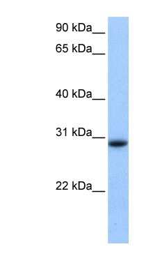 Western Blot: LOC139542 Antibody [NBP1-91393] - 721_B cell lysate, concentration 0.2-1 ug/ml.