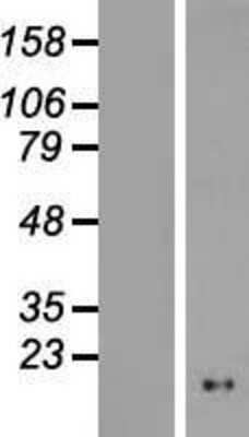 Western Blot: LOC149950 Overexpression Lysate (Adult Normal) [NBL1-12579] Left-Empty vector transfected control cell lysate (HEK293 cell lysate); Right -Over-expression Lysate for LOC149950.