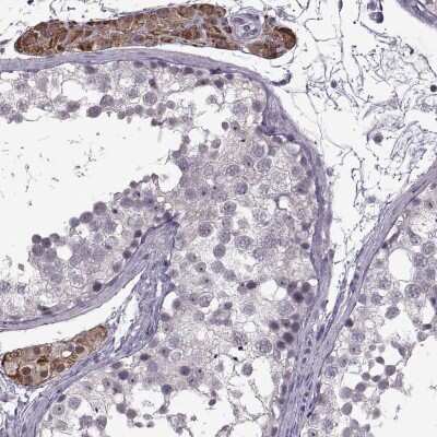 Immunohistochemistry-Paraffin MGAT4D Antibody - BSA Free