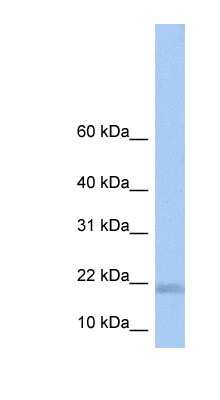 Western Blot: LOC284009 Antibody [NBP1-70605] - Human Lung lysate, concentration 0.2-1 ug/ml.