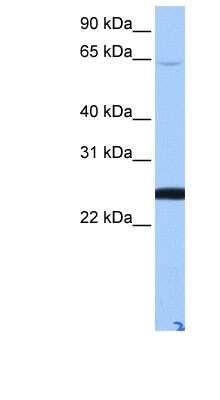 Western Blot: LOC344065 Antibody [NBP1-91395] - Human Lung lysate, concentration 0.2-1 ug/ml.