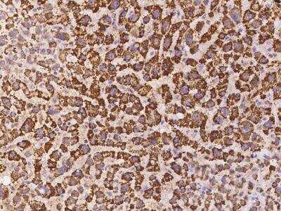 Immunohistochemistry-Paraffin: LOC388813 Antibody [NBP3-06030] - Immunochemical staining of human LOC388813 in human liver with rabbit polyclonal antibody at 1:300 dilution, formalin-fixed paraffin embedded sections.