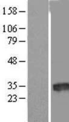 Western Blot: LOC388882 Overexpression Lysate (Adult Normal) [NBL1-12597] Left-Empty vector transfected control cell lysate (HEK293 cell lysate); Right -Over-expression Lysate for LOC388882.