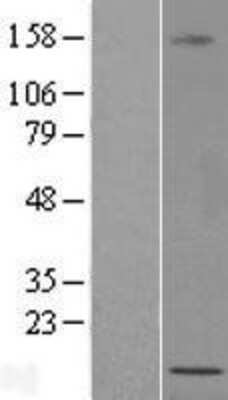 Western Blot: LOC389458 Overexpression Lysate (Adult Normal) [NBL1-12599] Left-Empty vector transfected control cell lysate (HEK293 cell lysate); Right -Over-expression Lysate for LOC389458.